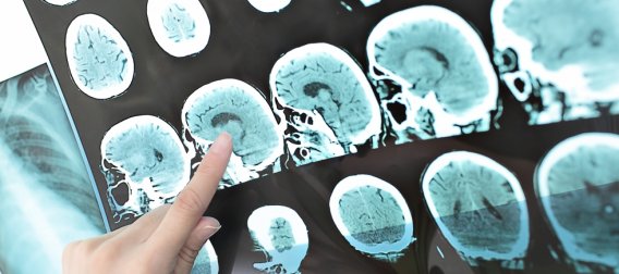 APCS | The Academy of Psychological Clinical Science APCS | The Academy of