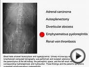 Charité Clinical Journal Club by Fred Luft - 17.12.2014